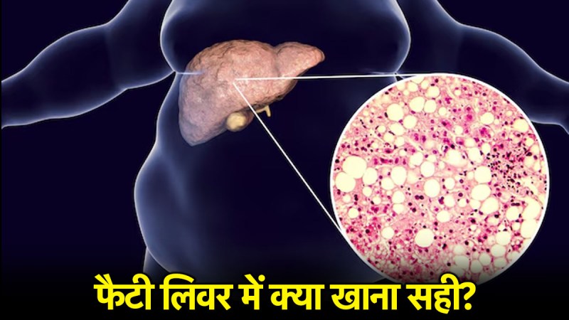 Fatty Liver Disease