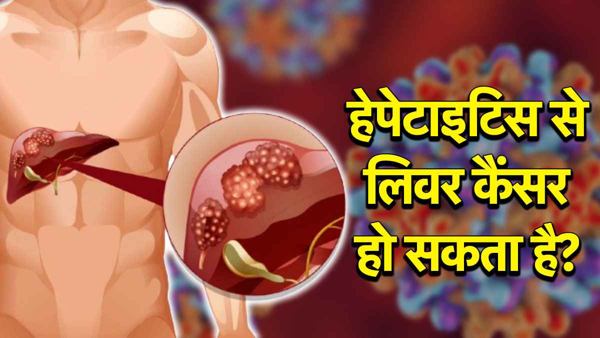 Liver Health Tips: भारत में हेपेटाइटिस-बी का बढ़ रहा रिस्क, जानें लिवर की इस बीमारी के बारे में