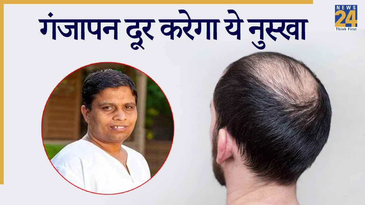 गंजेपन को रोकने के लिए अपनाएं ये घरेलू उपाय, आचार्य बालकृष्ण ने गिनवाए फायदे