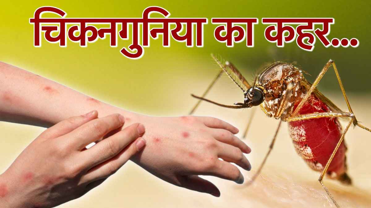 चीन में चिकनगुनिया से मची 'तबाही', 7000 नए केस मिले, जानें लक्षण और बचाव