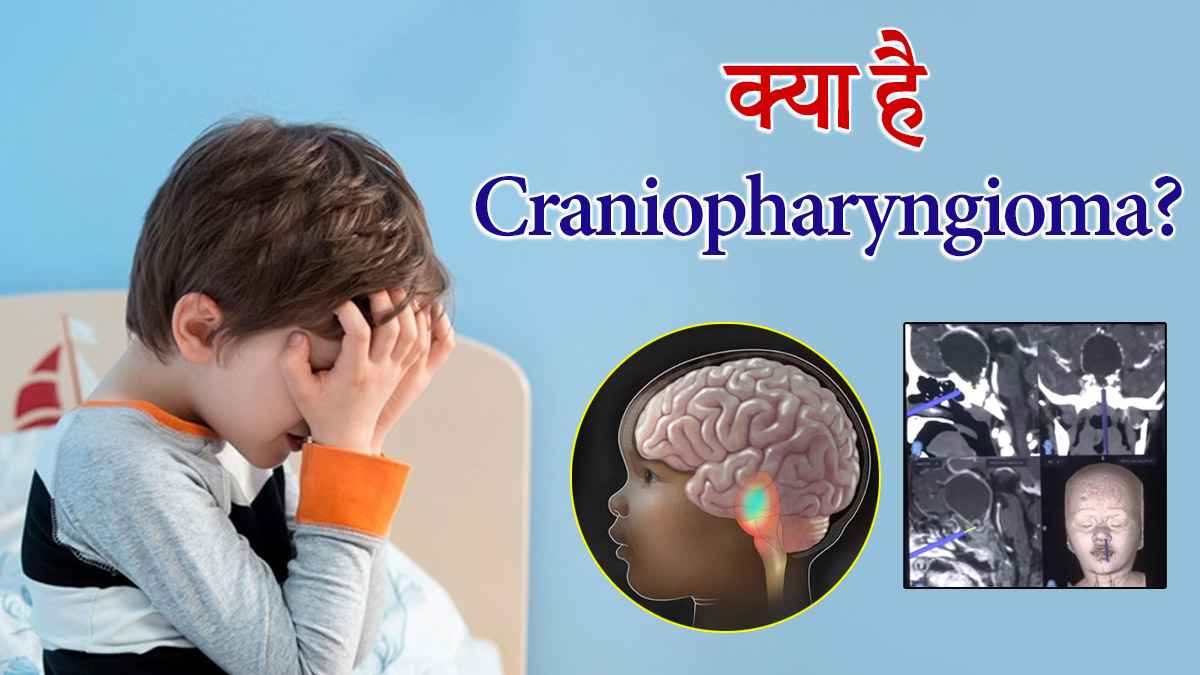 डॉक्टरों ने किया कमाल, 2 साल की बच्ची के ब्रेन ट्यूमर की नाक से हुई सर्जरी