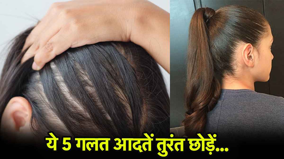 Hair Care: बाल टूटने की समस्या से परेशान? एक्सपर्ट से जानिए 5 आदतें जो बढ़ाती हैं नुकसान