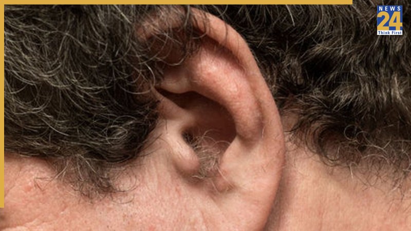 Hair on Ears