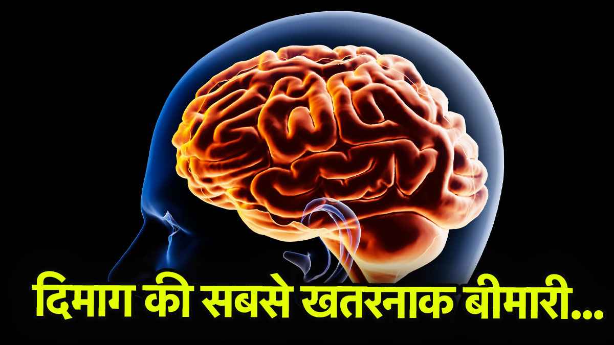 Health Tips: फिल्म सैयारा में दिखी खौफनाक हकीकत, एक्ट्रेस को हुआ अल्जाइमर- जानिए इसके लक्षण