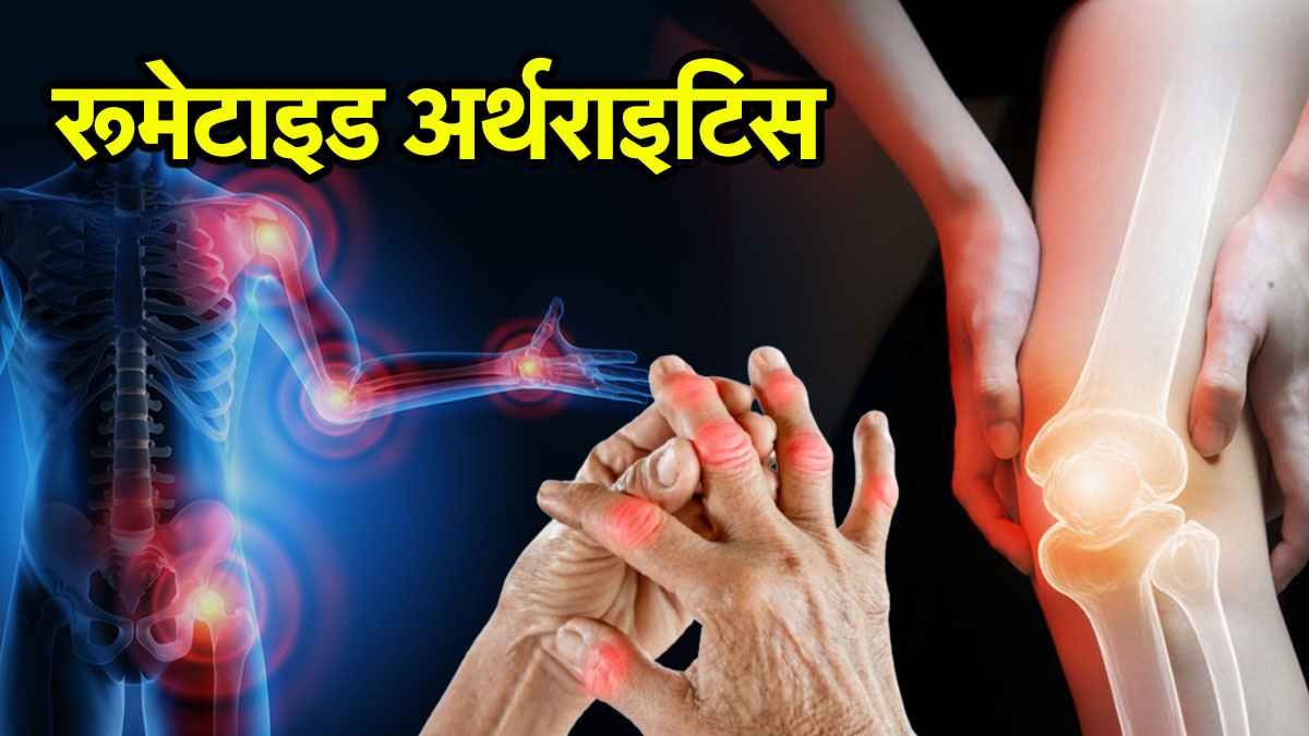 3 हफ्तों से ज्यादा जोड़ों में दर्द होना इस गंभीर बीमारी का संकेत, एक्सपर्ट से जानिए बचाव के तरीके