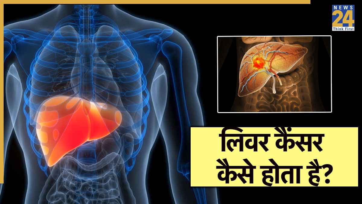 लिवर कैंसर कैसे होता है? ये 5 लक्षण दिखते ही हो जाएं सावधान, डॉक्टर ने बताया बचने का तरीका