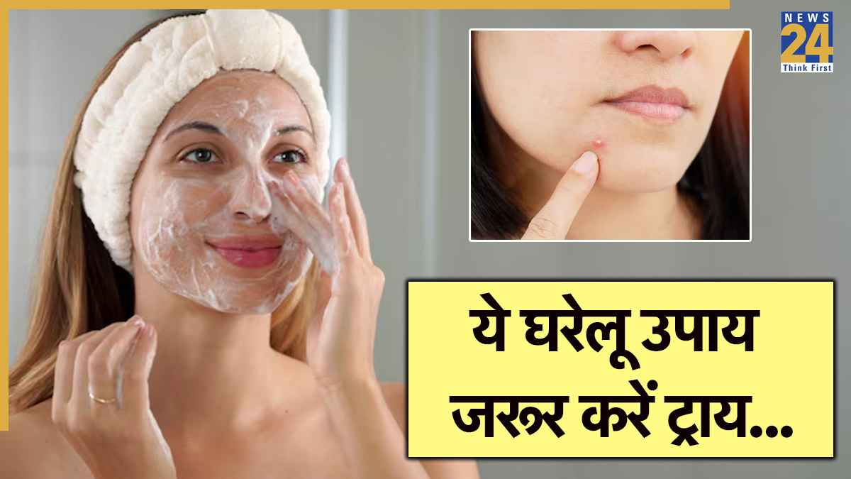 Skin Care: घर बैठे पिंपल-फ्री स्किन कैसे पाएं? एक्सपर्ट ने बताया सटीक तरीका