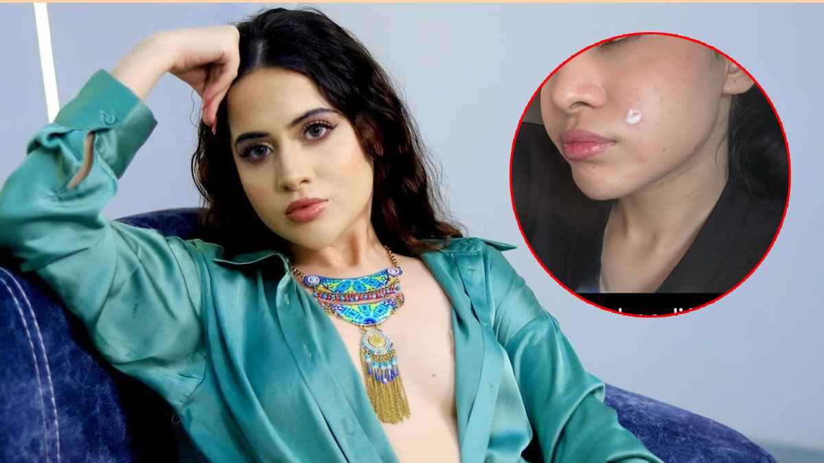 Urfi Javed के चेहरे पर किसने किया अटैक? एक्ट्रेस ने सोशल मीडिया पर बांटी तकलीफ