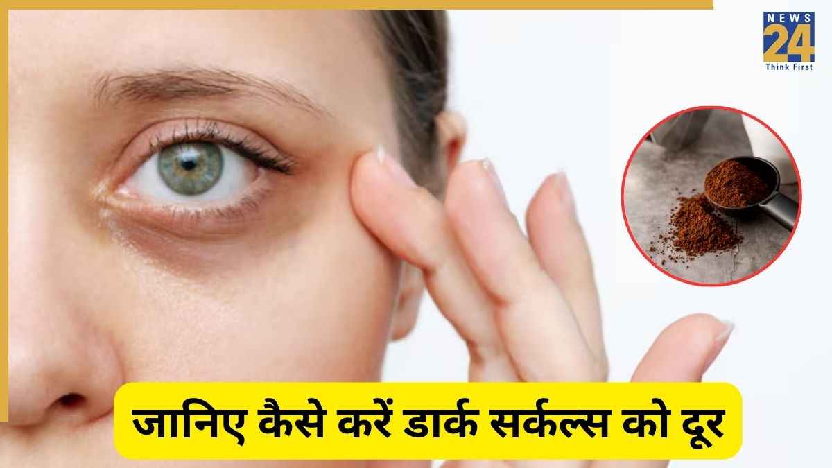 आंखों के नीचे बढ़ रहे हैं काले घेरे ? इन 3 चीजों से मिल जाएगा Dark Circles से छुटकारा