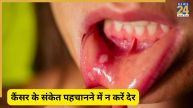 ORAL CANCER