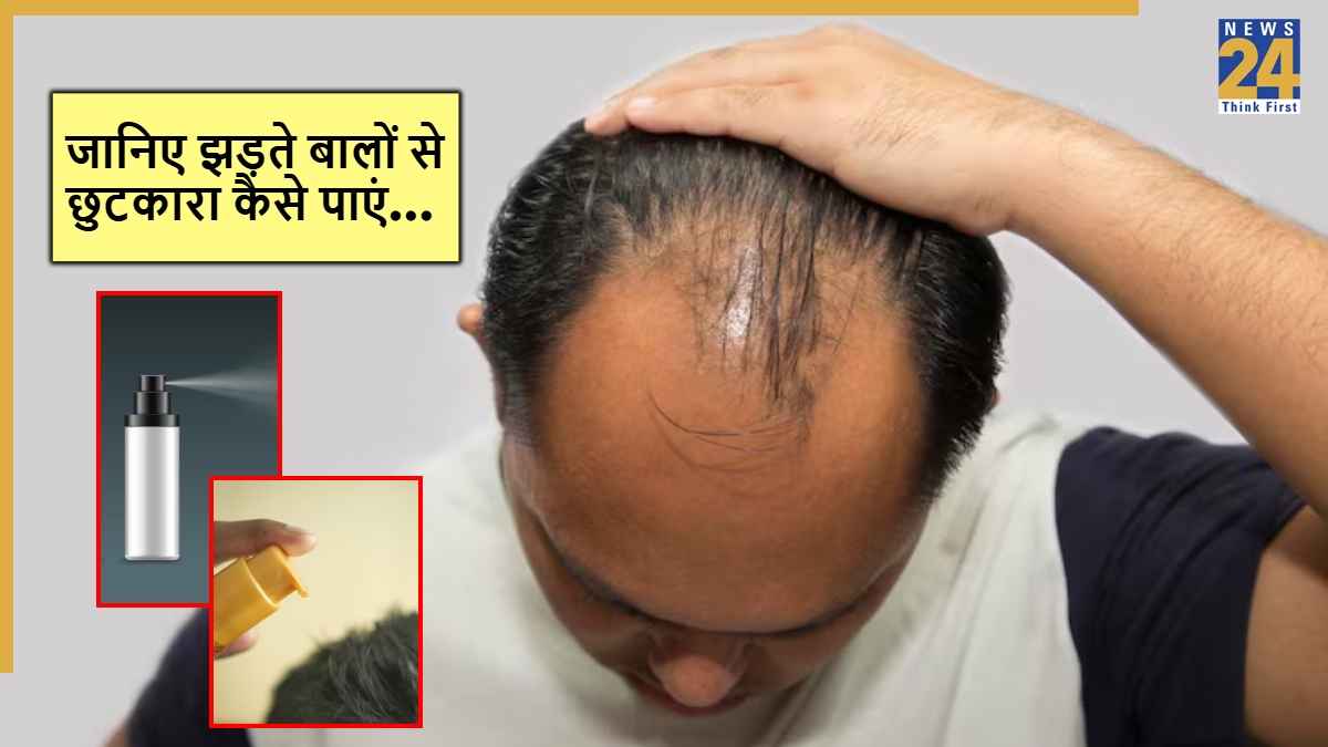 Hair Fall Reasons: हेयर लॉस से हैं परेशान? तो इन 4 आसान बदलावों से बचा सकते हैं बाल