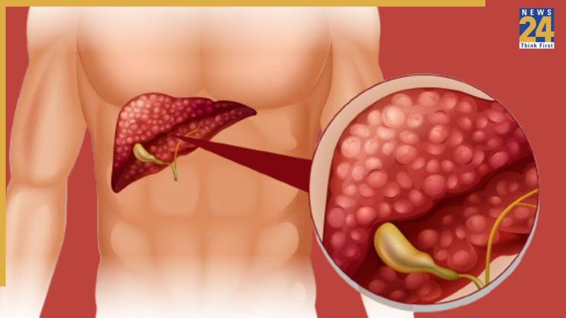 Liver Cancer Sympptoms
