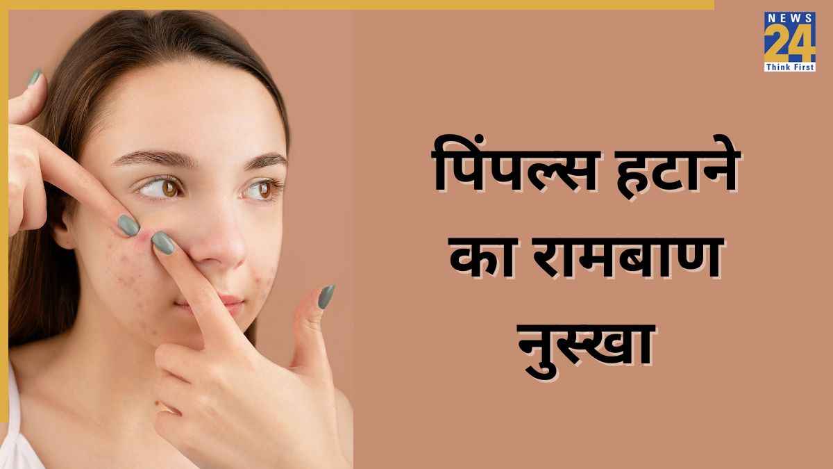 Pimple Home Remedies