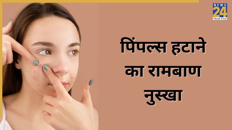 Pimple Home Remedies