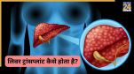 Liver Transplant