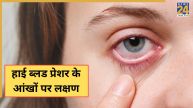 High BP Symptoms