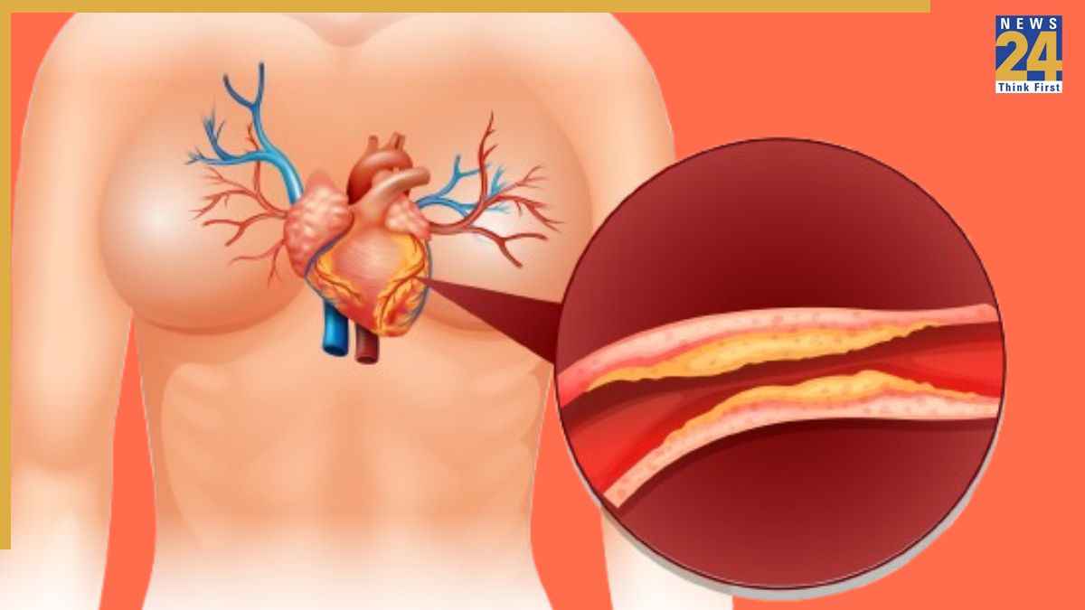 हार्ट ब्लॉकेज में कौन सा योग करना चाहिए? एक्सपर्ट ने बताया क्या करने से साफ होने लगेगा नसों में जमा प्लाक