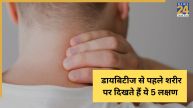 Diabetes Symptoms