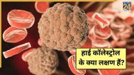 High Cholesterol Symptoms