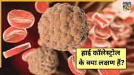 High Cholesterol Symptoms