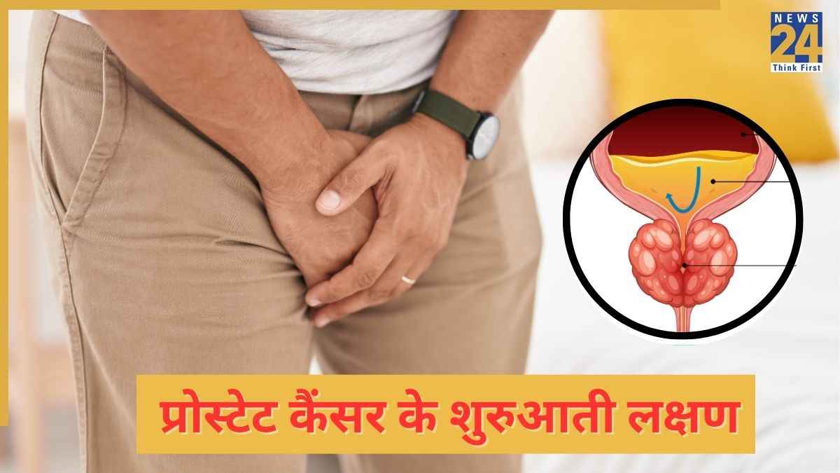 Prostate Cancer