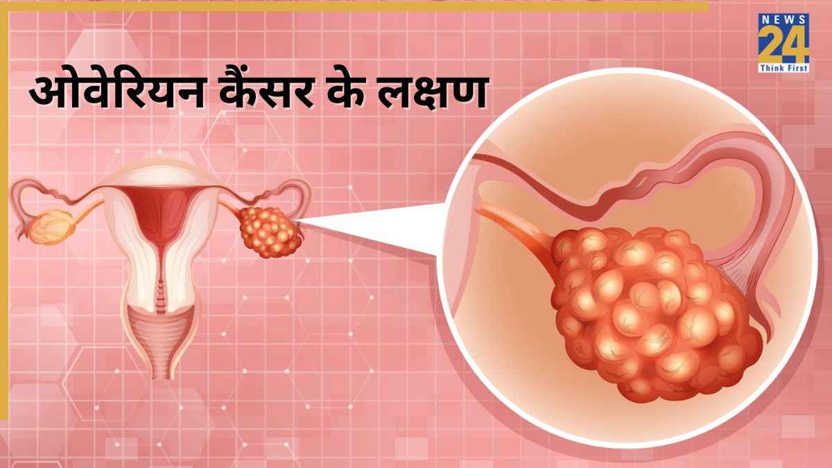 अंडाशय का कैंसर होने पर कैसे लक्षण दिखते हैं? जानिए Ovarian Cancer किन महिलाओं को हो सकता है