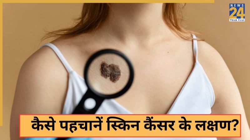 Skin Cancer