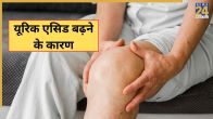 Uric Acid Causes