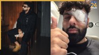 Badshah Injured, Badshah, Badshah Photos