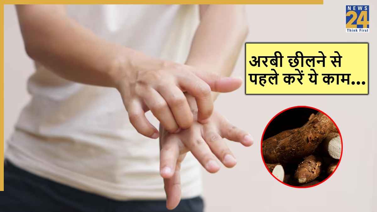 Kitchen Tips: अरबी छीलने पर हाथों में होती है खुजली, इन 5 तरीकों से काटेंगे तो नहीं होगी परेशानी