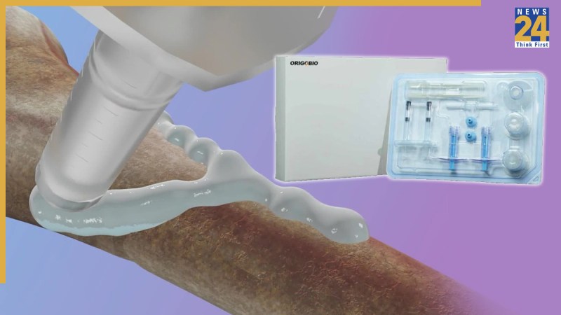 Bone Glue | Medical Innovation | China