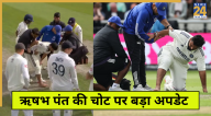 Rishabh Pant Injury Update