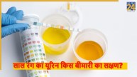 urine symptoms