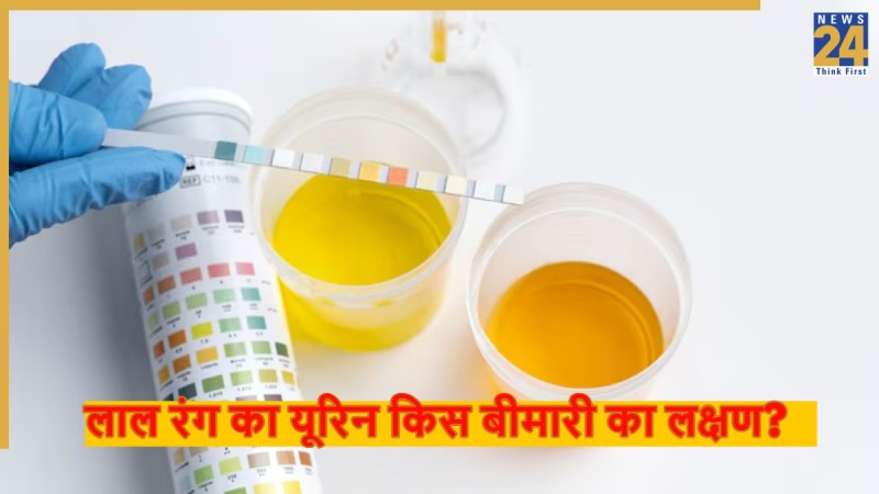urine symptoms