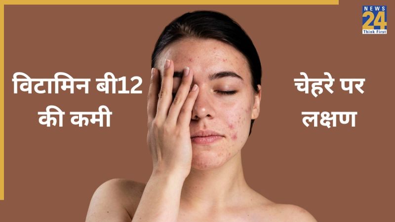 Vitamin B12 Deficiency