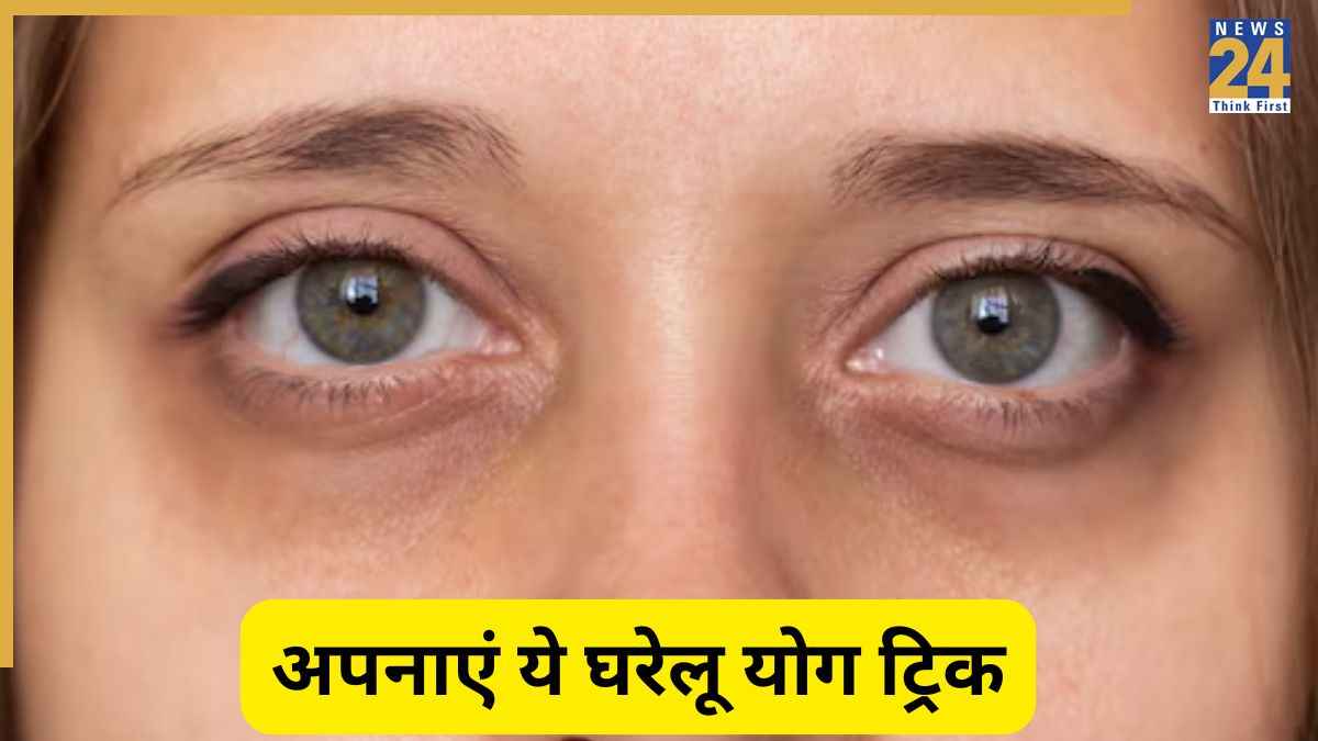 dark circles
