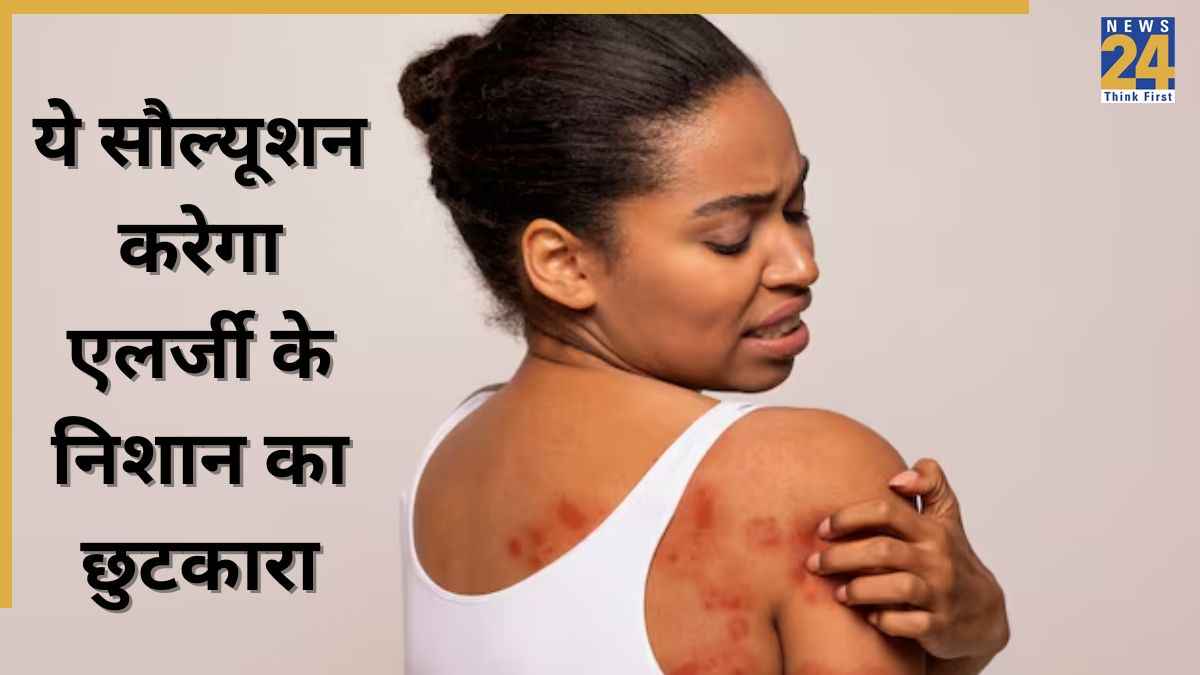 Allergy Marks: स्किन एलर्जी के दाग दब्बे रह गए हैं बॉडी में? इस नुस्खे को आजमाएं, निशानों का हो जाएगा सफाया