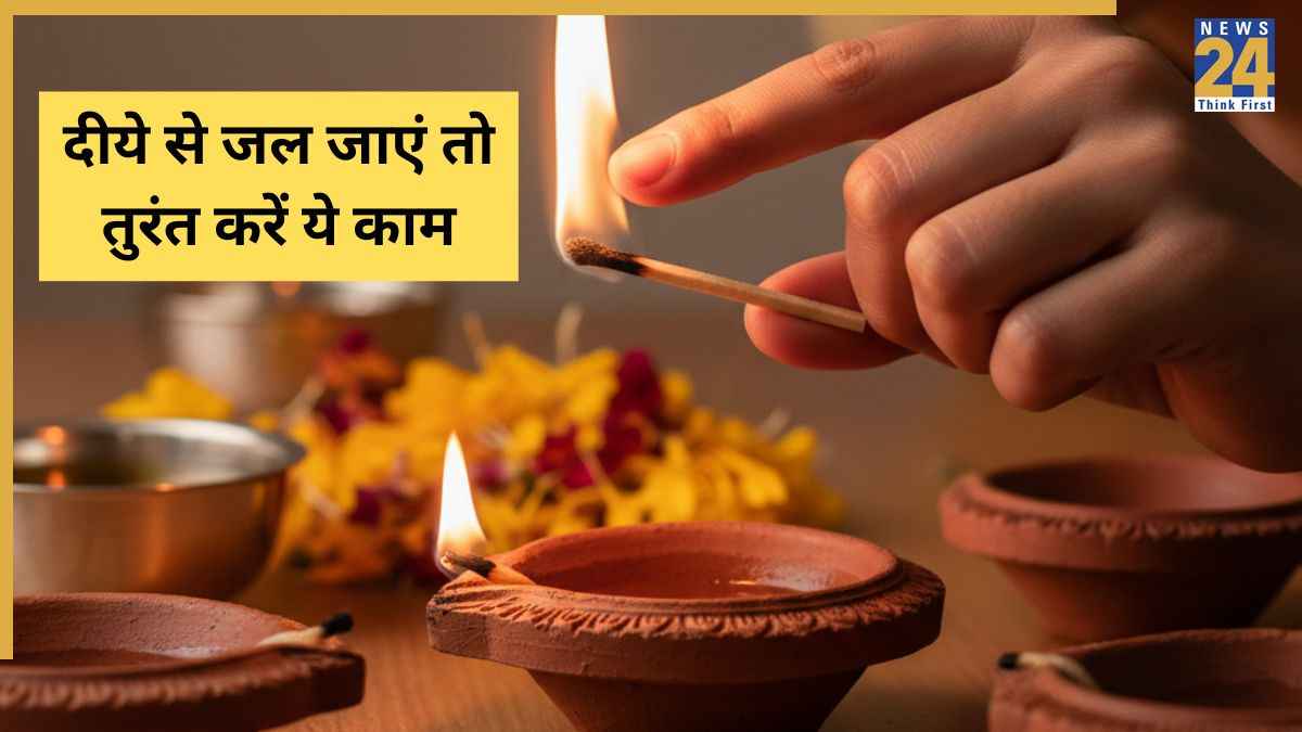 Diwali Burn