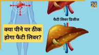 Fatty Liver Disease