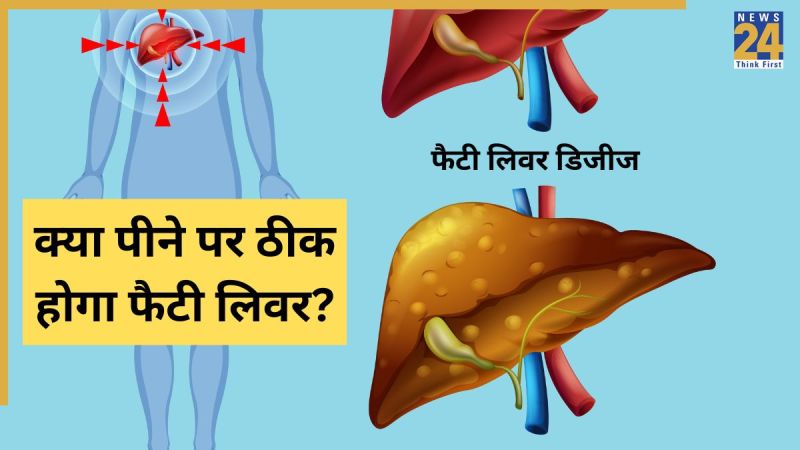 Fatty Liver Disease