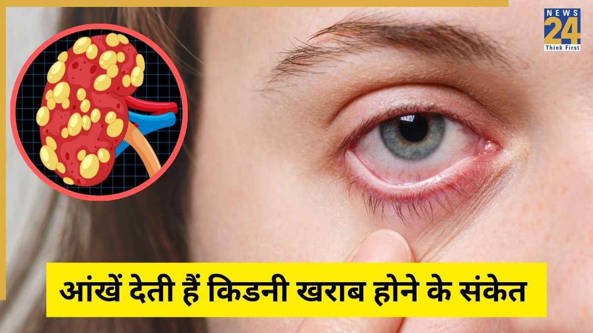 आंखों पर भी नजर आते हैं किडनी खराब होने के लक्षण, जानिए Kidney Disease का पहला संकेत क्या होता है