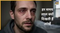 Red Eyes Causes