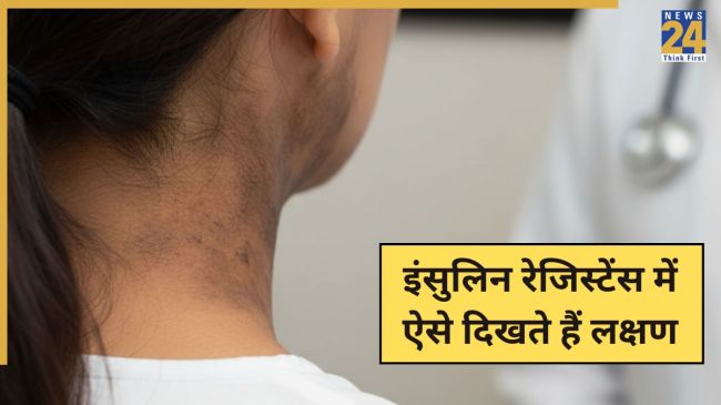 Insulin Resistance Sign