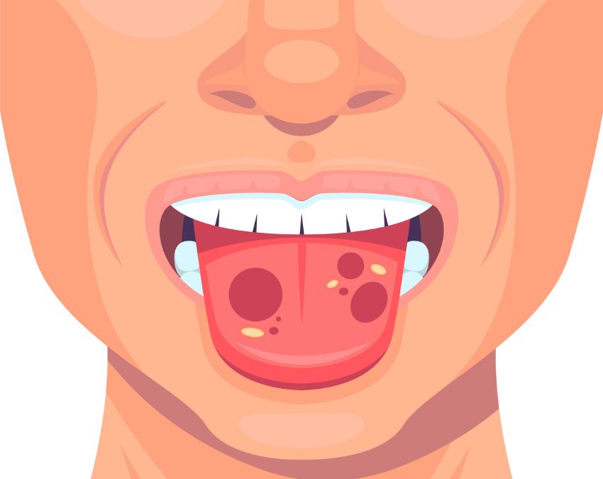 Feeling Sleepinh-1-2-3-4-5-6-7