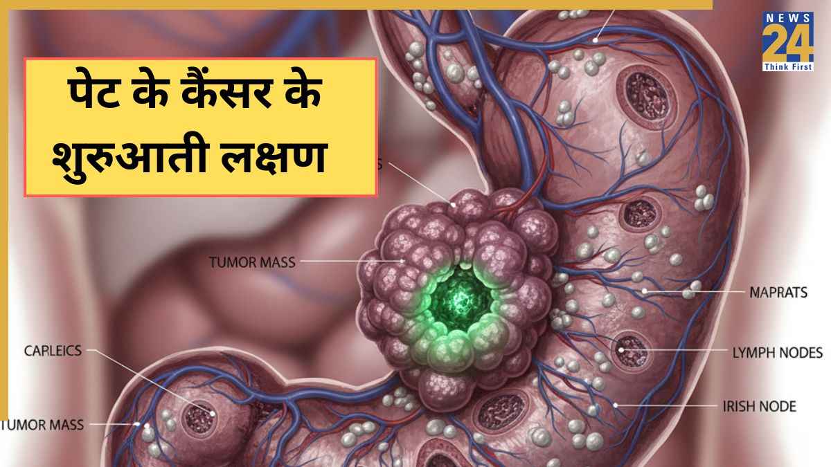 पेट के कैंसर की पहली स्टेज में शरीर देने लगता है ये 5 संकेत, समय रहते पहचानें इस तरह