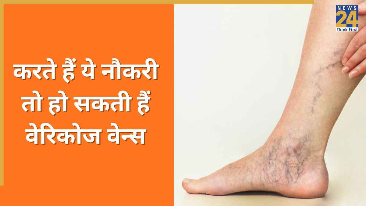 Varicose Veins का खतरा किन लोगों को ज्यादा होता है? वेरिकोज वेन्स स्पेशलिस्ट ने बताया ये 3 नौकरियों वाले हो सकते हैं शिकार