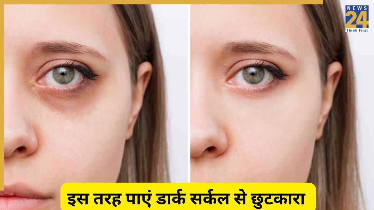 Dark Circles: आंखों के डार्क सर्कल्स हटाने का ये है आसान तरीका, किचन में मौजूद इन चीजों से ही मिल जाएगा छुटाकारा