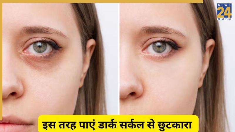 Dark Circles Dark Circles