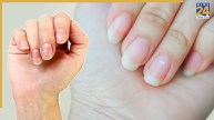 White-Spots-on-Nails