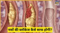 blocked arteries in legs